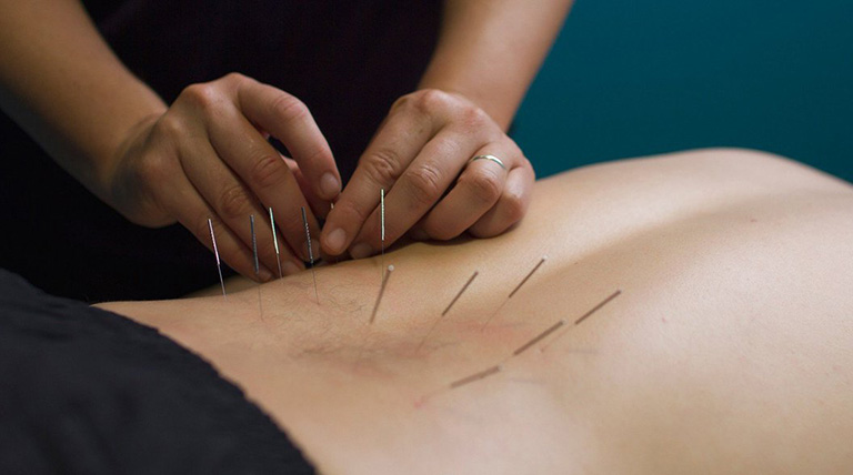 Hình ảnh minh họa dược liệu